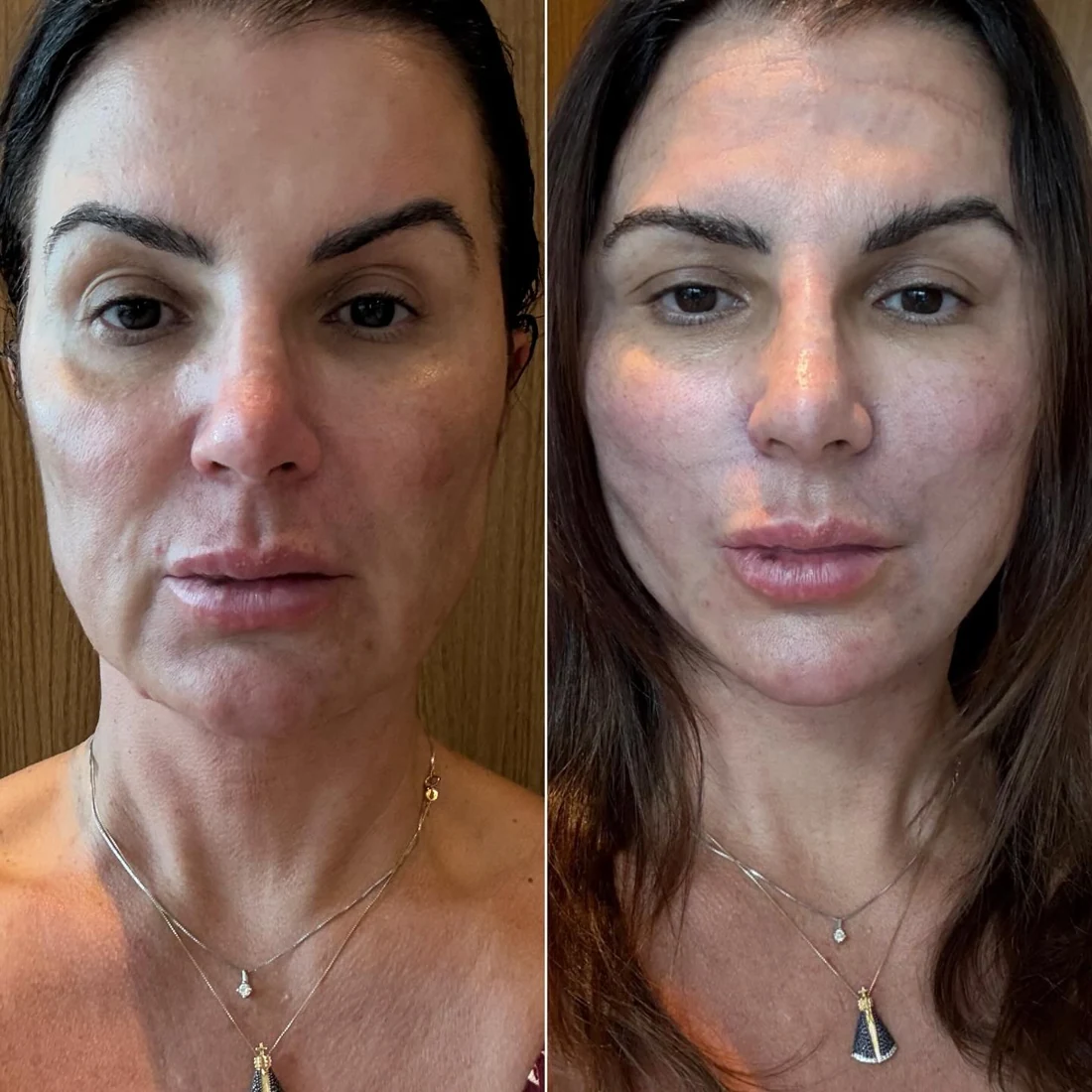 Comparação de antes e depois apresentada pela clínica, caso 19